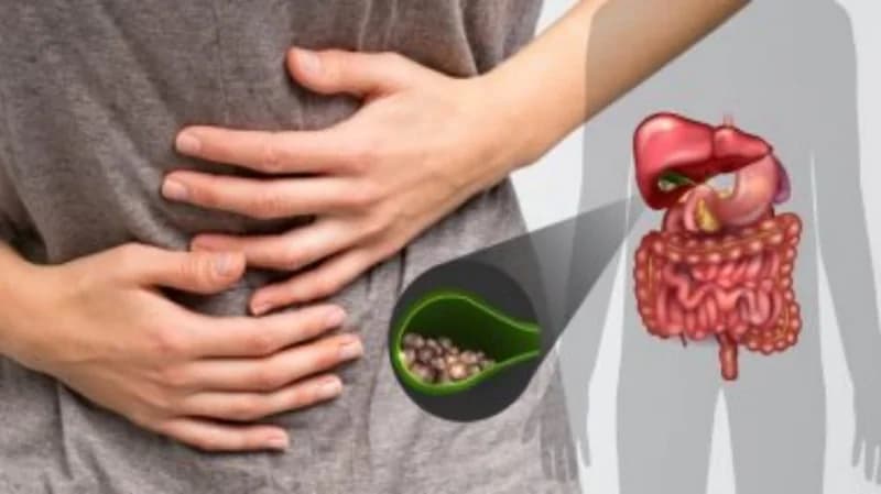 هل يمكن علاج حصوات المرارة بغير الجراحة؟.. طبيب باطنية يُجيب