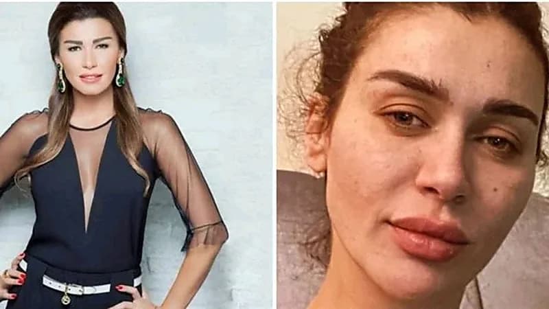 إطلالة صادمة لنادين الراسي بدون مكياج وبوجه شاحب