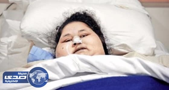 دواء تجريبي لإيمان المصرية " أسمن إمرأة في العالم " لتستطيع النطق والحركة