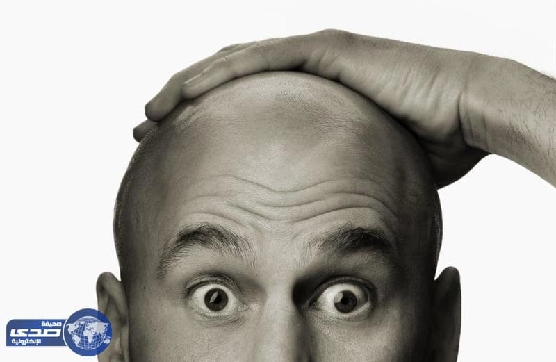 تعرف على مستوى جاذبية الرجل الأصلع لدى المرأة
