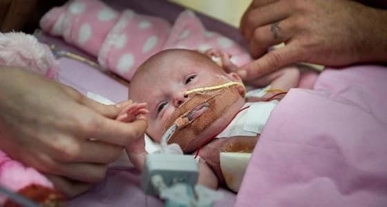 بالفيديو.. معجزة إنقاذ رضيعة ولدت بقلب خارجي