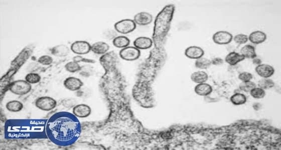 إصابة خمسة أشخاص بفيروس " هانتا " في واشنطن