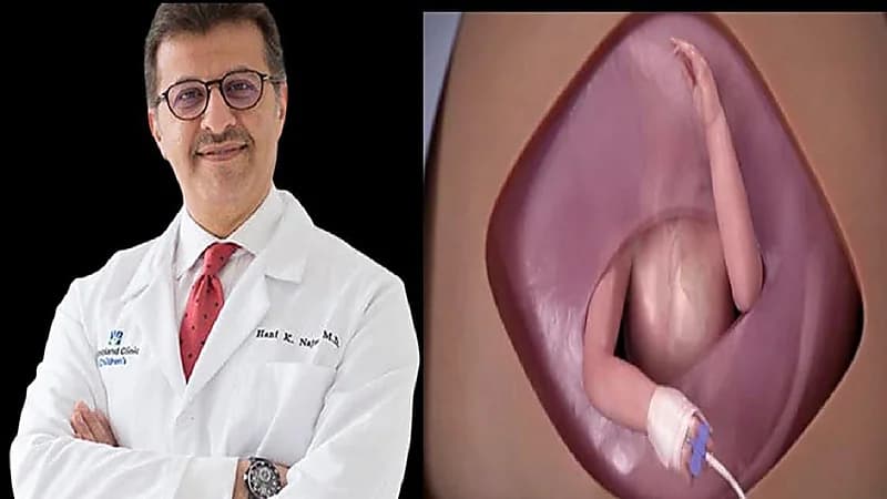 الطبيب السعودي يكشف تفاصيل العملية التي أجراها لقلب جنين في رحم أمه