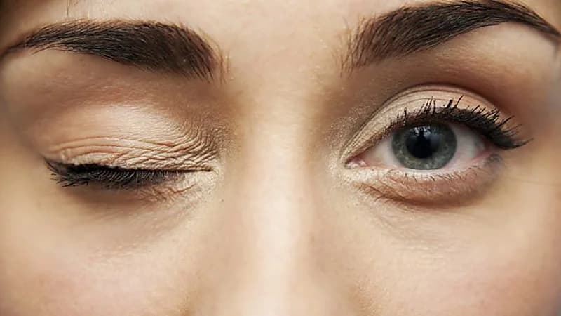 النمر: رفة العين ليست خطيرة ولا تحتاج علاج لدى الغالبية