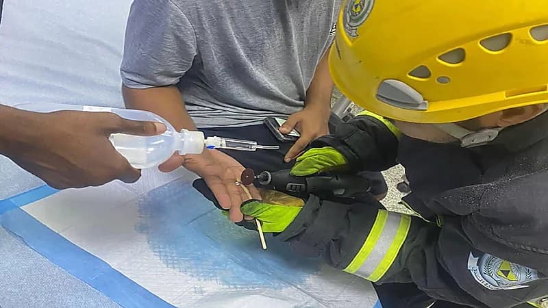 الدفاع المدني يحرر إصبع شخص علق في قطعة معدنية