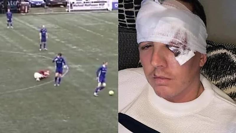 شاهد.. لاعب ينطح منافسه بوحشية خلال مباراة كرة قدم