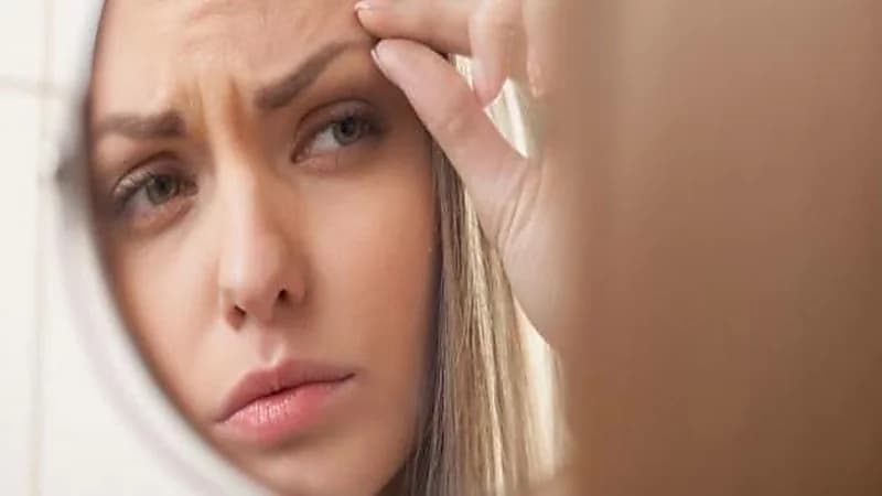 أسباب تساقط شعر الحاجب وطرق علاجه