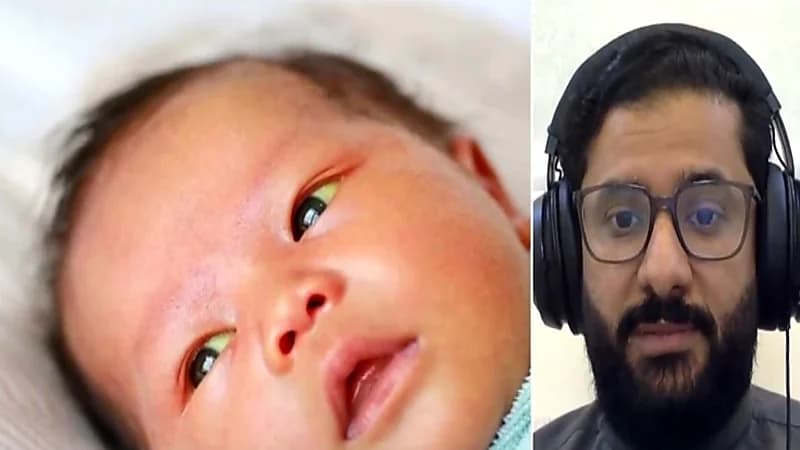 بالفيديو.. استشاري يكشف أسباب وأعراض اليرقان عند حديثي الولادة