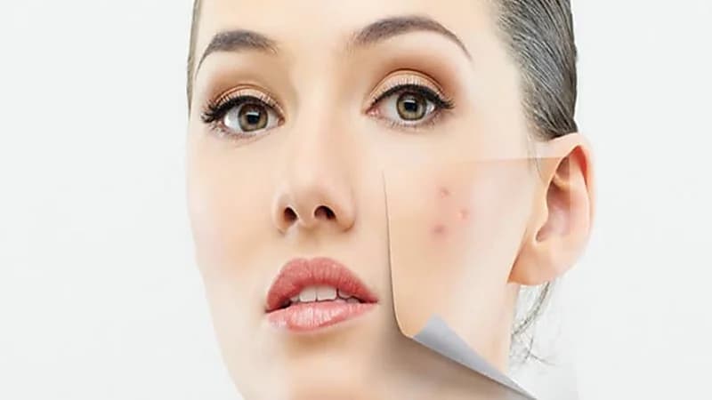 طرق الوقاية من إصابة البشرة بالبقع الداكنة