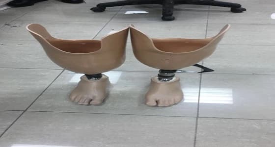 مجمع الملك فيصل بالطائف يؤهل مريضا للمشي بعد أن فقد قدميه