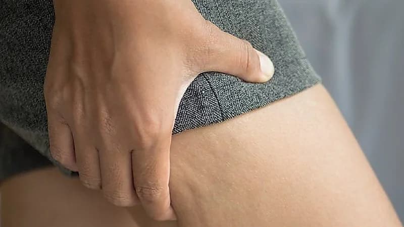 طرق علاج السيلوليت لدى المرأة