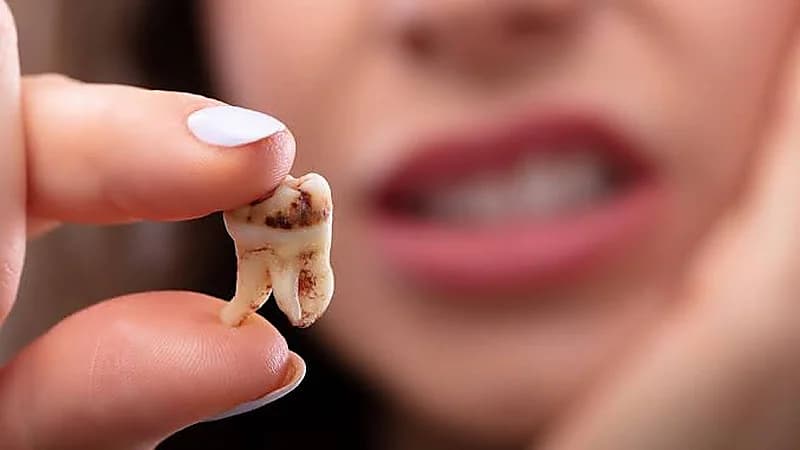 طرق الاعتناء بالأسنان وحمايتها من التسوس دون التخلي عن تناول الحلويات