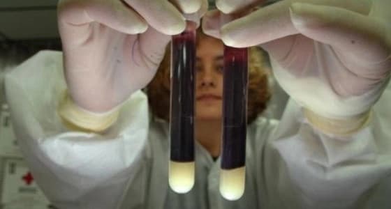 مرض خطير ينتشر مُستقبلاً بين البشر ويسبب الوفاة .. تعرف عليه