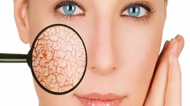 10 خطوات لتجنب جفاف البشرة خلال شهر رمضان