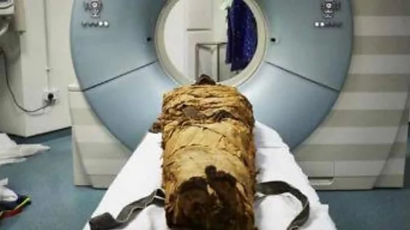 الكشف عن حقيقة أول مومياء حامل