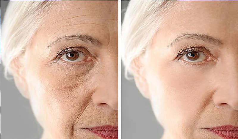 بالفيديو.. إجراءات ضرورية يجب مراعاتها في عمليات شد الوجه