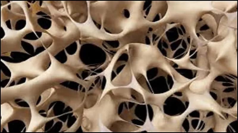 5 أطعمة تقي من هشاشة العظام