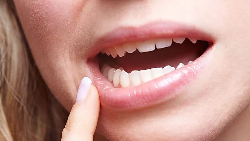 تقنية جديدة للكشف المبكر عن أمراض اللثة