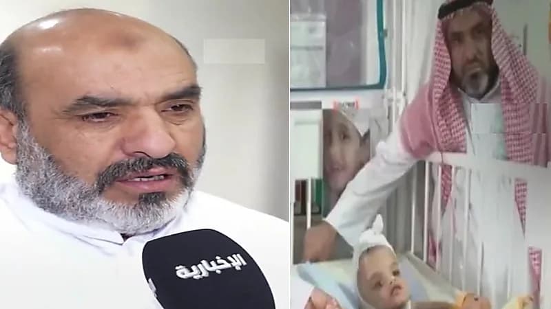 والد التوأم السيامي السوري يدعم أسرة التوأم البوركيني بعد نجاح العملية.. فيديو