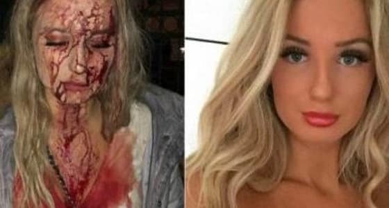 شاب يهشم وجه فتاة حسناء لرفضها التحرش بها