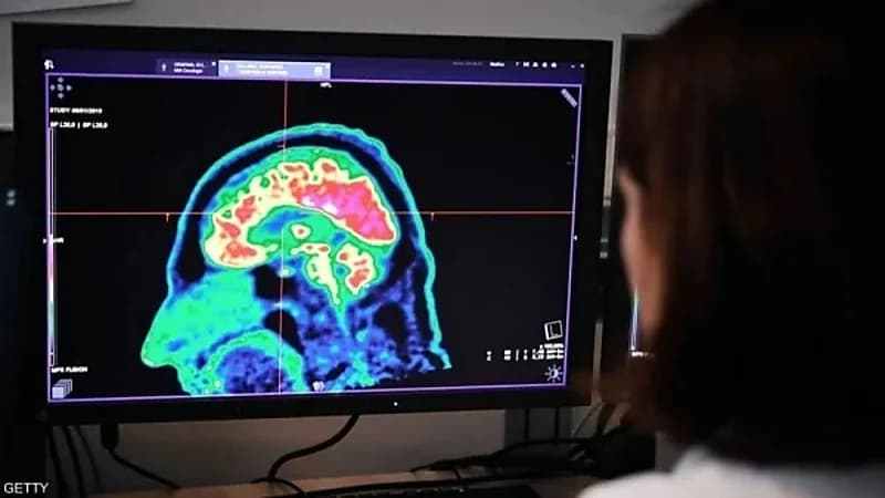 ظن القهوة سبب صداعه المستمر ليفاجأ بإصابته بورم في المخ