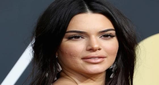 عارضة أزياء شهيرة تثير ضجة ببشرة وجهها السيئة