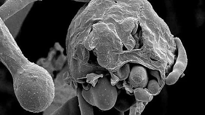 وفاة مصابة مصرية بالفطر الأسود رغم عدم إصابتها بـ«كورونا» 