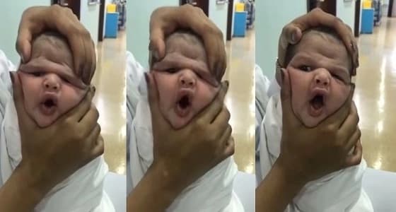 آخر تطورات قضية العبث في رضيع الطائف