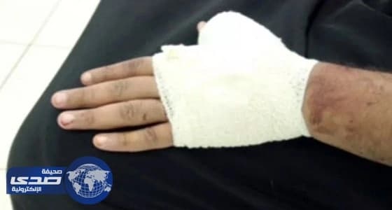 " سعود الطبية " تحذر من الاستخدام الخاطئ للسكاكين والسواطير