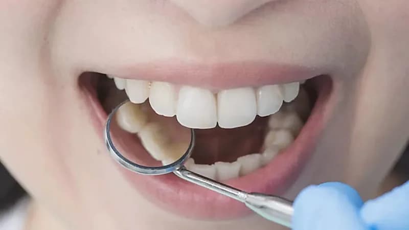 4 أطعمة يجب تجنبها لصحة أسنان جيدة