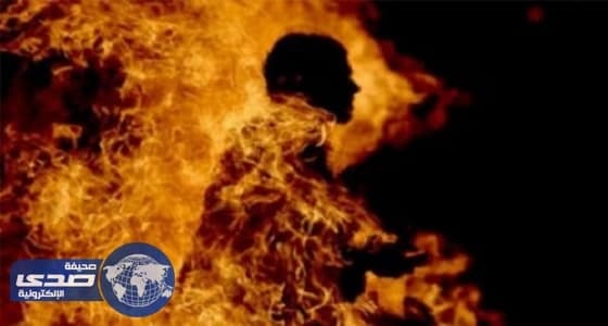 عامل يحرق جسد شقيقه بالسجائر حتى الموت