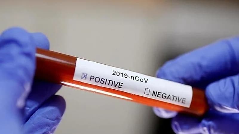 حقيقة العلاقة بين فصائل الدم وكورونا