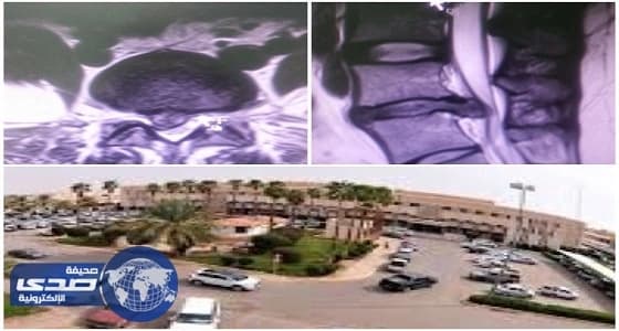 90 دقيقة في غرفة العمليات تعيد الحياة لثلاثينية بعنيزة