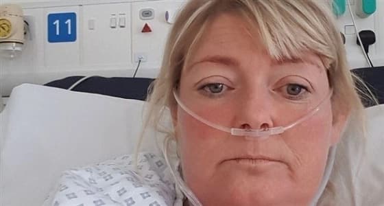 امرأة بريطانية تجري 4 عمليات زرع كلية في 24 سنة