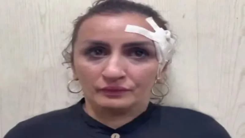 ضبط أم باعت رضيعها لإجراء عملية تجميل في أنفها