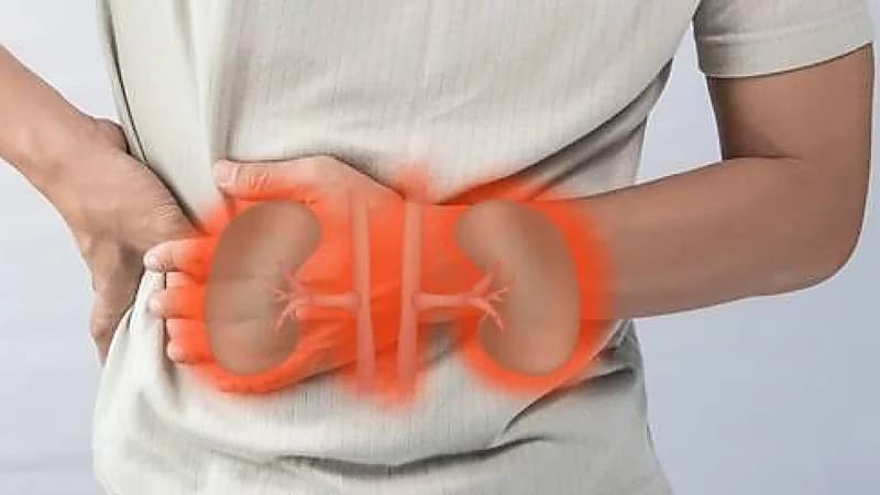 أبرز أعراض وعلامات الفشل الكلوي