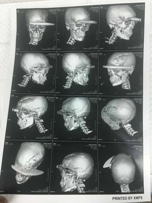 شاهد.. الحديثي يكشف عن طرق وآليات مواجهة ظاهرة التسول في شهر رمضان