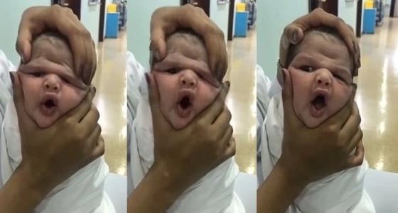 إحالة الممرضات العابثات بطفل الطائف للنيابة العامة