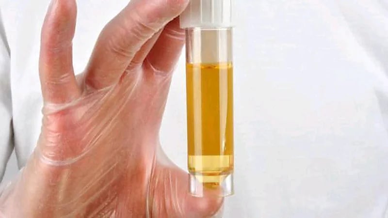 استشارية: الزلازل في البول مؤشر للإصابة بـ 3 أمراض