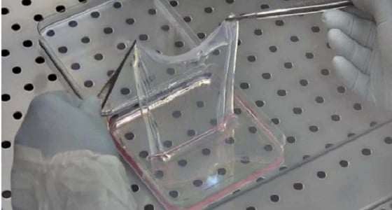 عملية معقدة تنقذ حياة طفل سوري من الموت بألمانيا