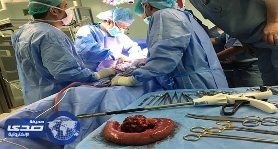 مجمع الملك فيصل الطبي بالطائف ينهي معاناة أربعينية