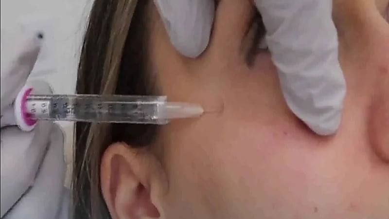 مختص : حقن "الفيلر" تحت العين خطر ويتطلب الخبرة