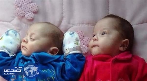 برازيلية تُنجب توأم بعد وفاتها دماغياً بعدة أشهر