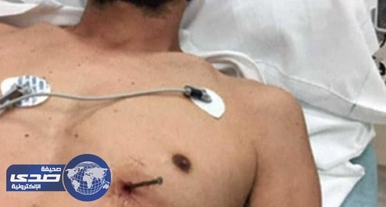 ⁠⁠⁠⁠⁠" قرار صعب " أنقذ حياة أمريكي استقر مسمار في قلبه