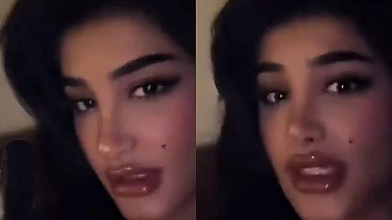 ميلان السبيعي: سويت تجميل بفلوسي والله يرزق كل محروم.. فيديو