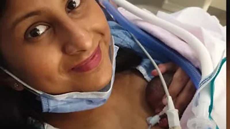 شاهد.. توأم بحجم كف اليد يدخل موسوعة جينيس