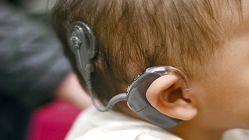 مختص: المملكة تقدم عمليات زراعة القوقعة مجاناً للأطفال