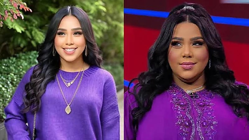 شيماء سيف تستعرض رشاقتها بعد خسارة وزنها .. فيديو