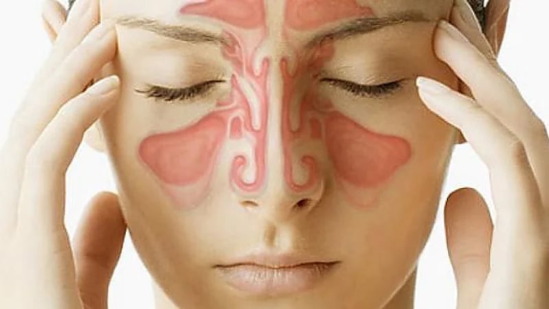 طبيب يوضح طرق علاج التهاب الجيوب الأنفية