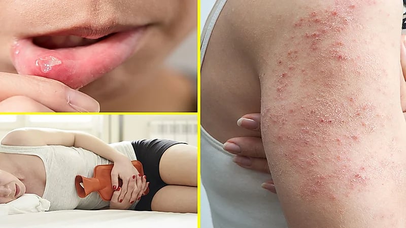 استشاري يوضح أعراض الإصابة بالسيلياك وكيفية التعامل مع المرض.. فيديو